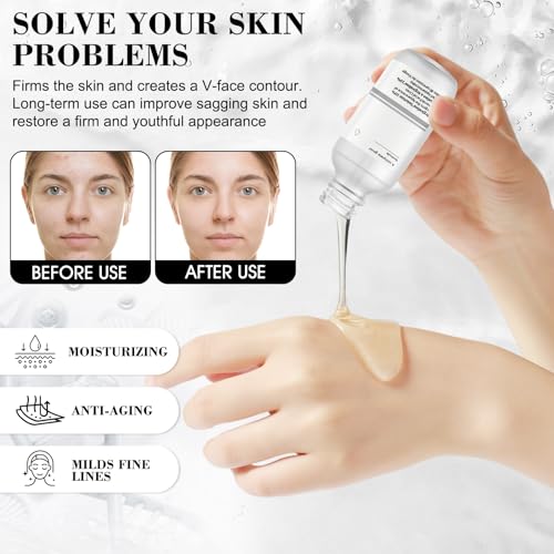 41u4dtoqmml.jpg Niacinamide Serum 10%+Zinc 1%, Hautunreinheiten Beheben, Poren Verfeinern und Fahle Haut Reduzieren, 2pcs*30ml