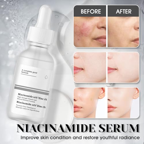 51haa0m2prl.jpg Niacinamide Serum 10%+Zinc 1%, Hautunreinheiten Beheben, Poren Verfeinern und Fahle Haut Reduzieren, 2pcs*30ml