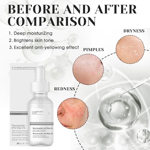 51aqhcmac3l.jpg Niacinamide Serum 10%+Zinc 1%, Hautunreinheiten Beheben, Poren Verfeinern und Fahle Haut Reduzieren, 2pcs*30ml