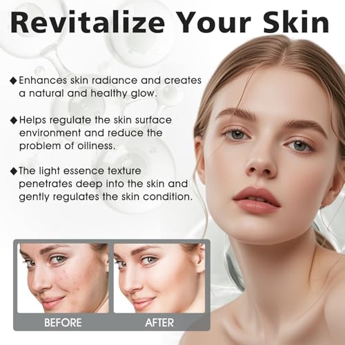 51qtbahq6ol.jpg Niacinamide Serum 10%+Zinc 1%, Hautunreinheiten Beheben, Poren Verfeinern und Fahle Haut Reduzieren, 2pcs*30ml