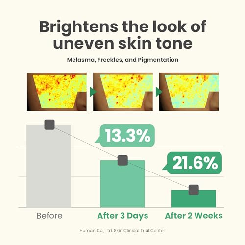 41efhyjkj7l.jpg AXIS-Y Glow Serum Für Korrekte Dunkle Flecken 5% Niacinamid, Veganer Koreanischer Hautpflege, Niacinamid Serum Für Alle