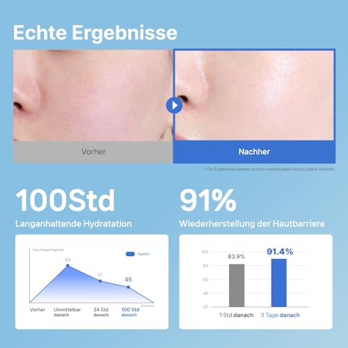 41rcp6c3azl.jpg ILLIYOON Ceramide Reichhaltige Feuchtigkeitscreme 200ml, für trockene und empfindliche Kinder- und Erwachsenenhaut, 100