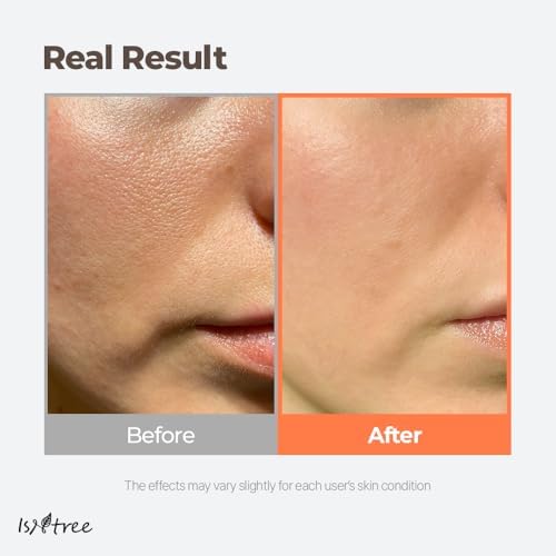 41winhplbdl. ac .jpg ISNTREE Grüner Tee Reinigungssirup 200 ml | Tiefenbefeuchtend für empfindliche, fettige, trockene Haut | Hyaluronsäure,